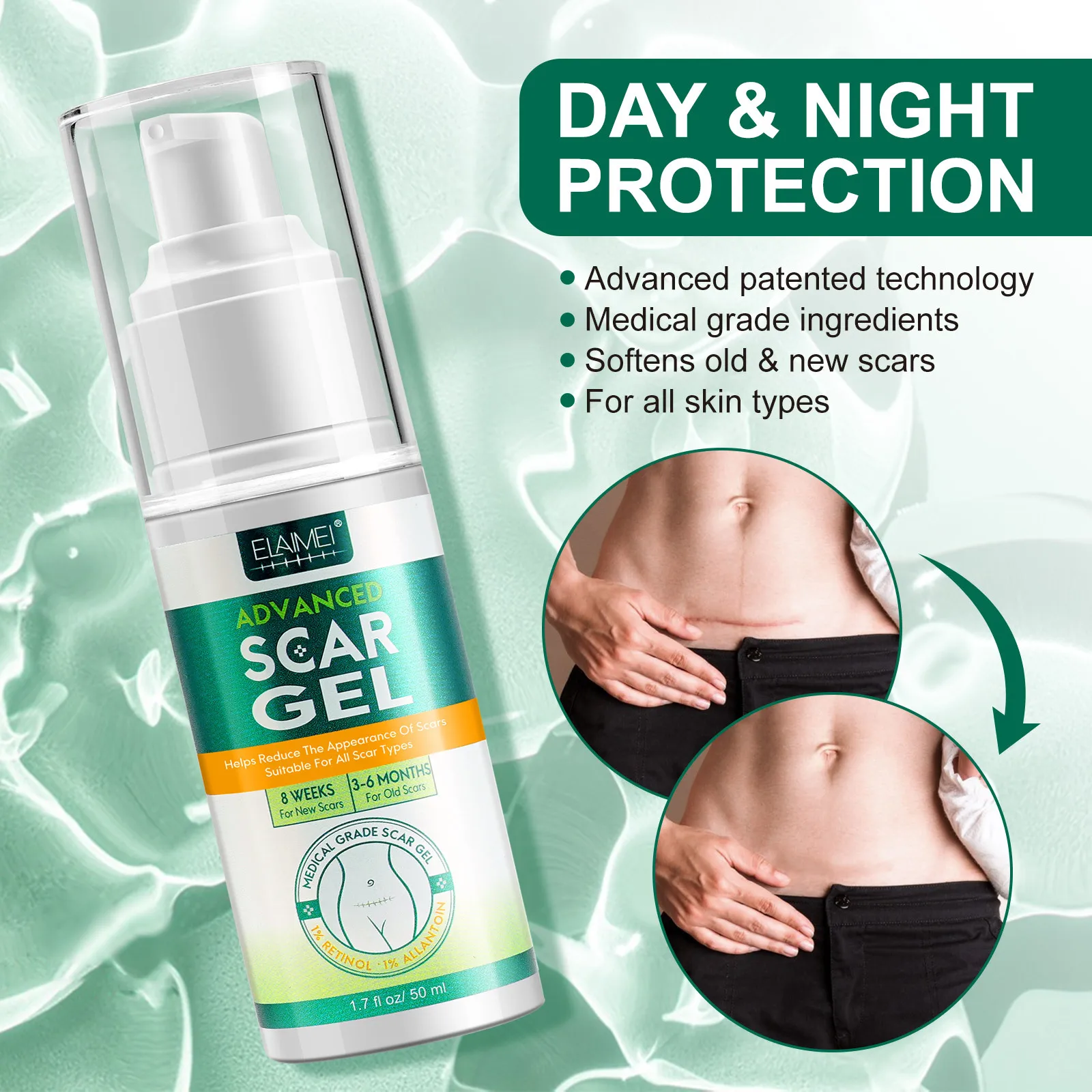 ELAIMEI Best Effective Scar Removal Advanced Repair Scar Gel