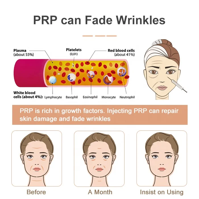 LONGTIME Medical Platelet Rich Plasma Glass Tube PRP Kit for sale