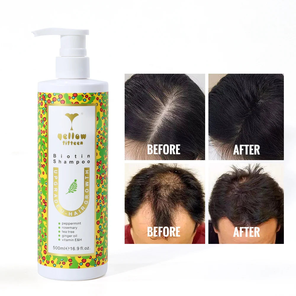 Private Label CPNP Certified Silicone Free Clear Base Vitamin E Rosemary Hair Growth Biotin Hair Thickening Shampoo