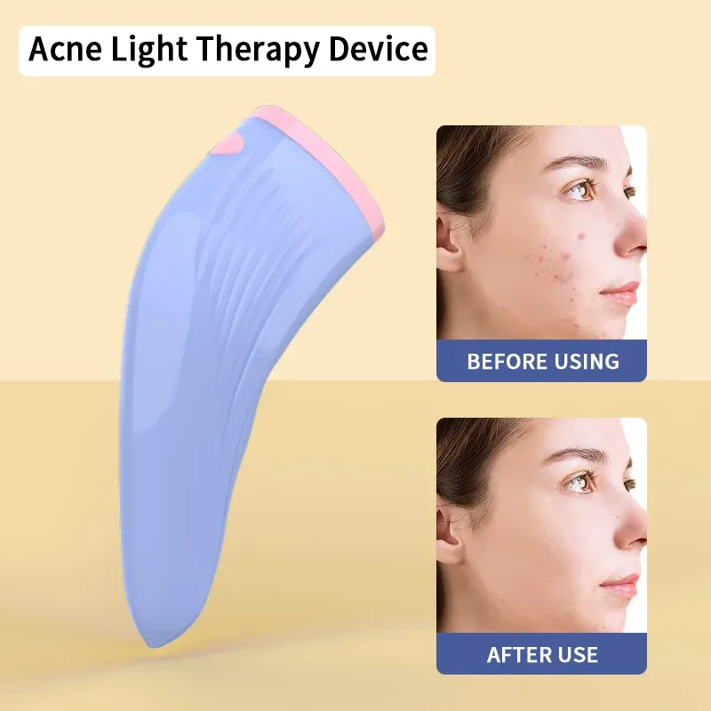 Home Use Beauty Skincare Portable 3 Minute Pimple Acne Spot Treatment Face Wand Led Red & Blue Face Light Therapy Beauty Device