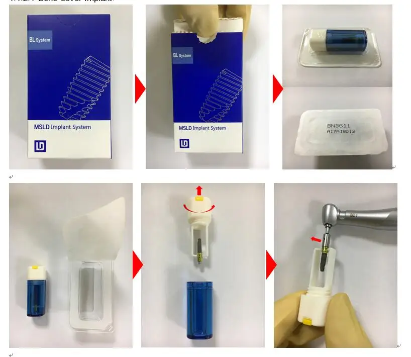 Dental Implant Fixture And Screw And Abutment Implants & Interventional Materials