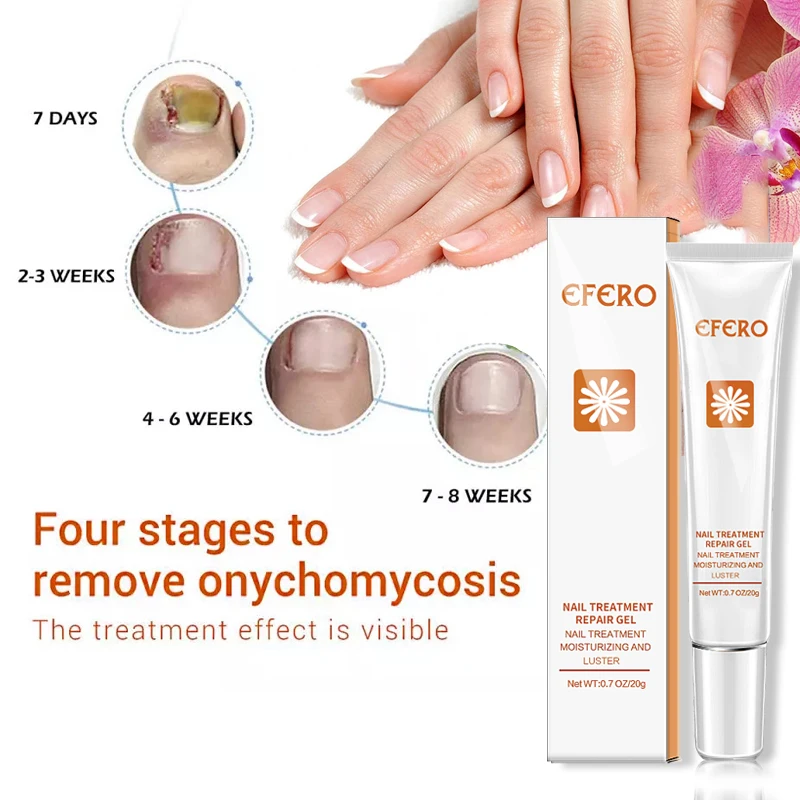 Feet Toe Care Treatment Foot Nail Fungus Removal Gel Anti Infection Paronychia Onychomycosis Fungal Nail Repair Essence Serum