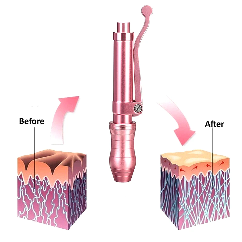 Hot Pink hyaluronic pen Hyaluronic Acid Guns No Injection Serum Pen For Anti-wrinkle Skin Rejuvenation Lips Lifting LipAtomizer