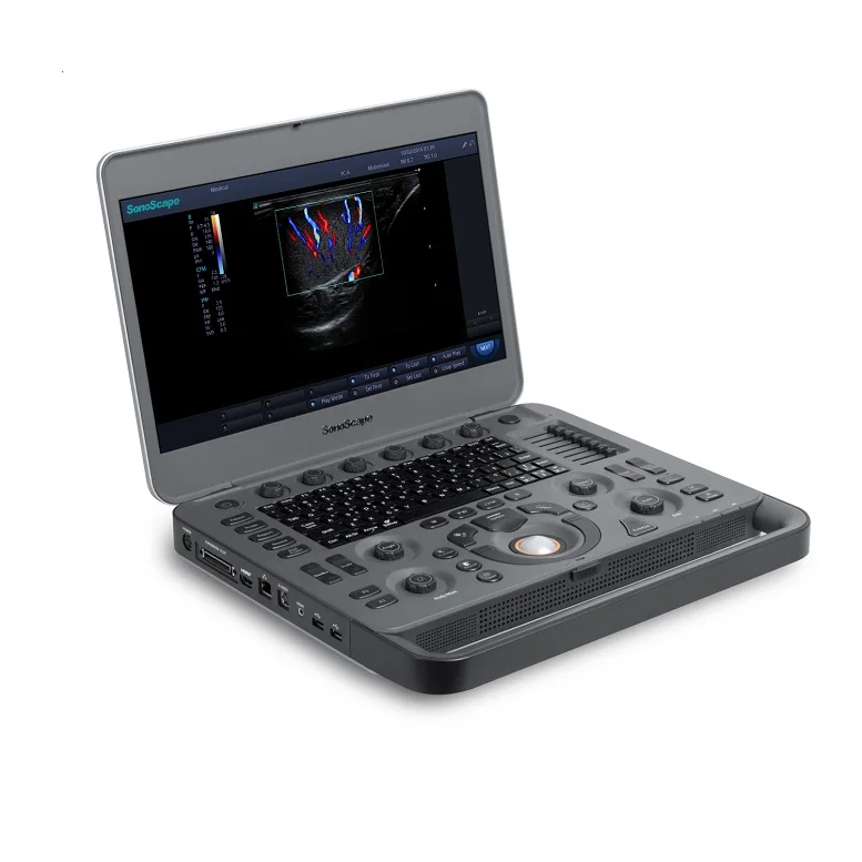  CE ISO SonoScape x5 портативный ультразвуковой аппарат допплер X5