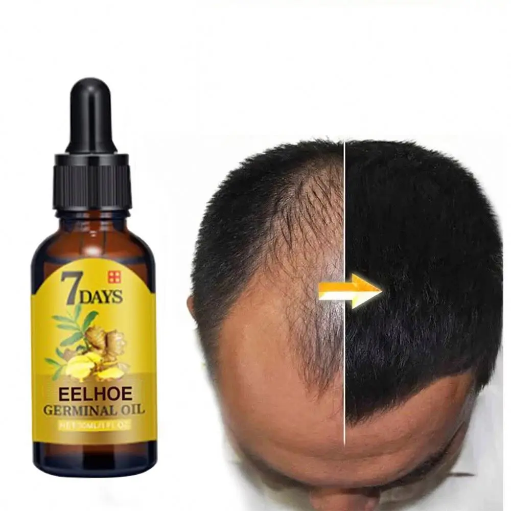 Wholesale Ginger Oil 7 Days Hair Growth Essential Oil For Hair Loss Treatment Regrowth Serum Turmeric Organic Germinal Essence