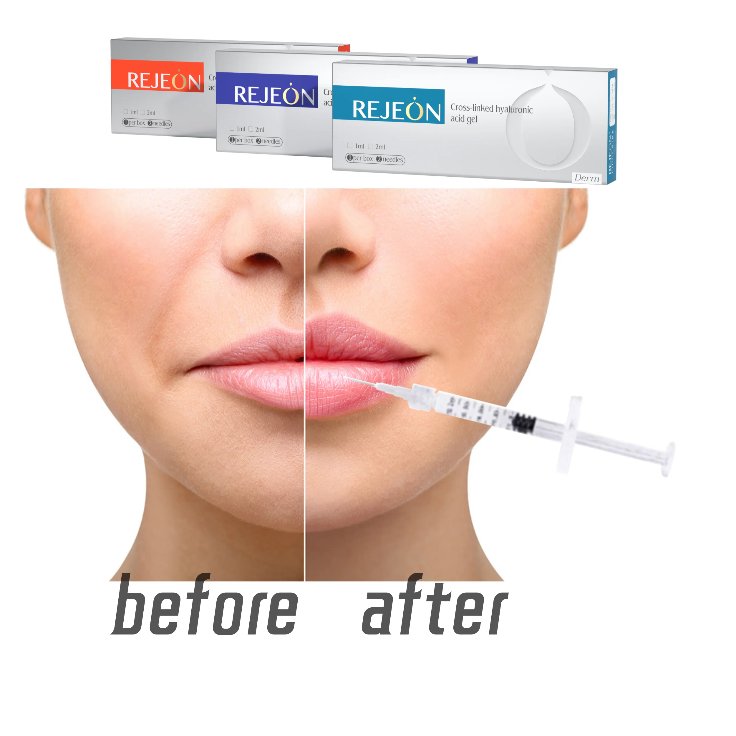 REJEON Original manufacturer supply 100% pure injectable Hyaluronic Acid HA Face Dermal Filler to remove Smile lines