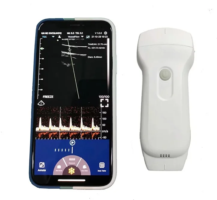 MC27 Approved by professional doctors convenient wireless 3 in 1 ultrasound probe usg for abdom, small organs and cardiac