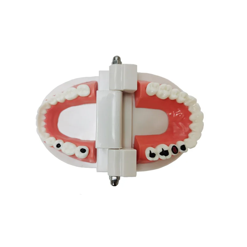 Life Size Tooth Decay Model For Oral Care Teaching Dental Tooth Care Model For Kids