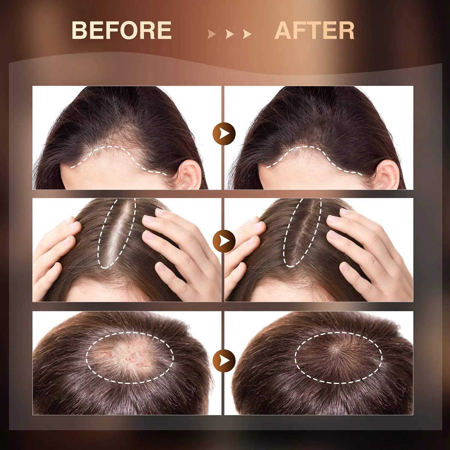 Hot amazon sale Hair Growth Oil Regrowth Stop Hair Loss Biotin hair growth serum