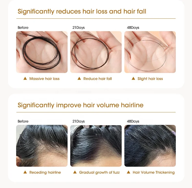 100% Natural Private Label Organic Castor Essential Oils Men Women Scalp Care Serum Hair Treatment Growth Rosemary Oil