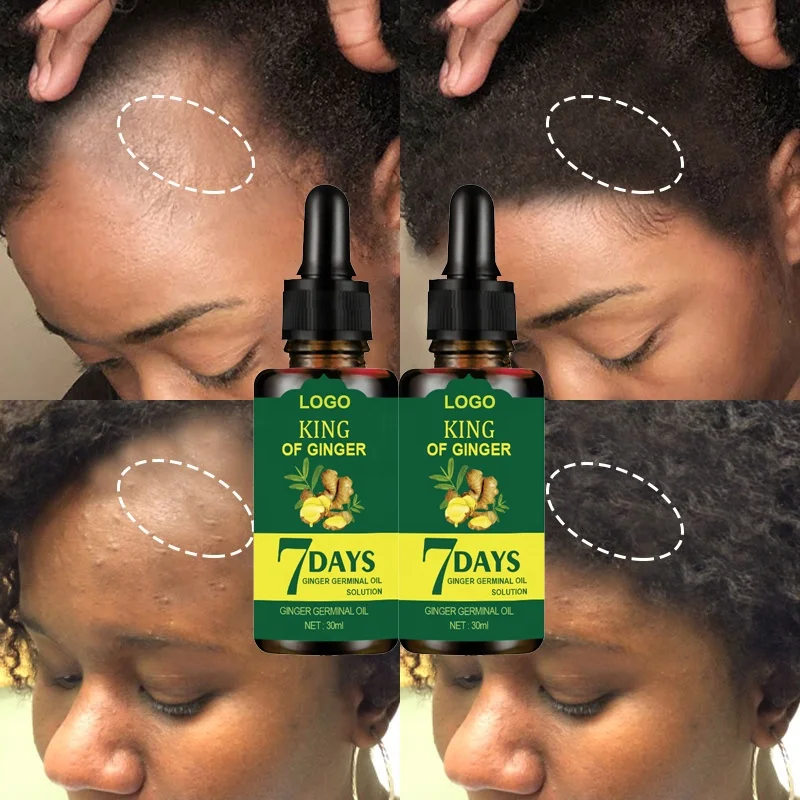 Private Label Natural Organic Hair Care Loss Treatment Serum Anti Hair Loss Promote Hair Growth 7 Days Ginger Essential Oil