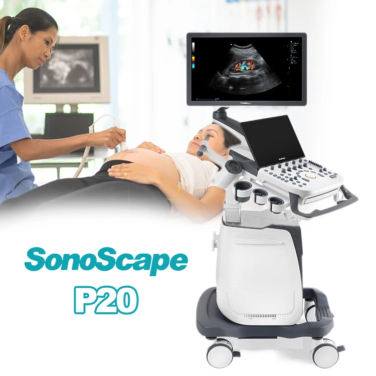 Высококачественный ультразвуковой 3d аппарат sonoscape 4d ветеринарный сканер для людей