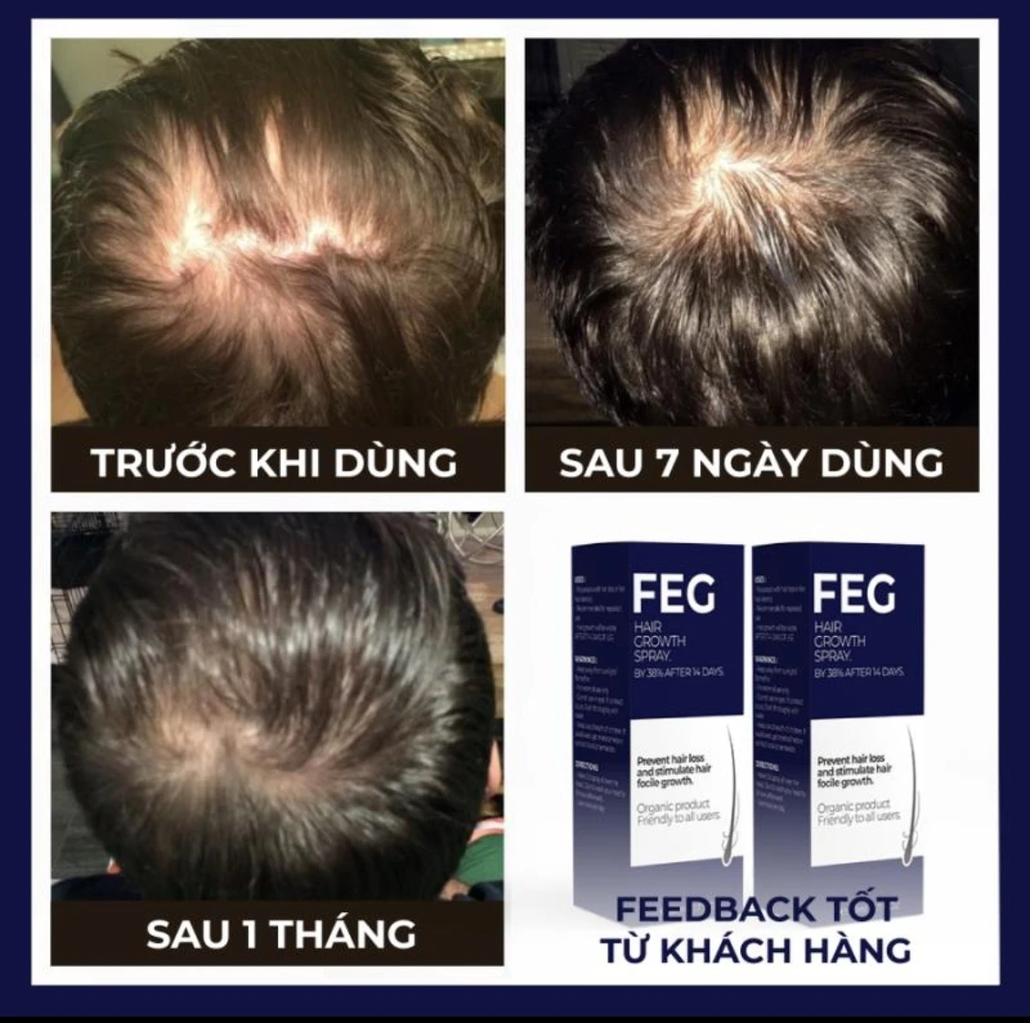 Organic Nourishing Prevent Hair Loss And Stimulate Hair Follicle Growth Hair Growth Spray