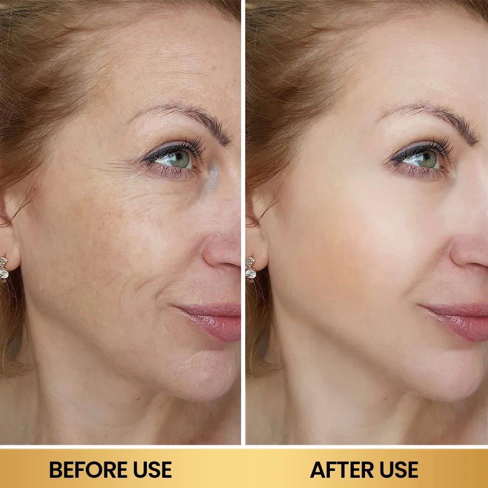 Private Label Luxury 99.9% Xylane Pro Cream Peptide Anti Aging Repair Wrinkle Regenerating Facial Moisturizer Lotion Face Cream