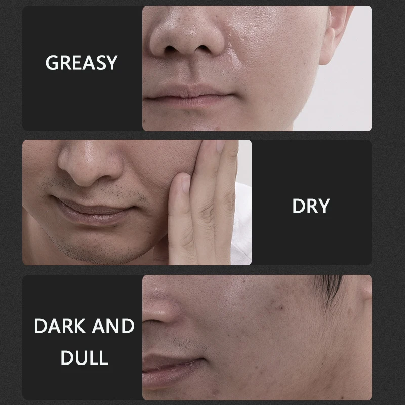 Увлажняющий крем для лица