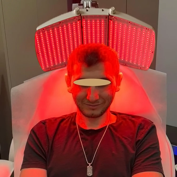 SVATAR Red 650-660nm Photo Dynamic Therapy (PDT) LED Light Therapy Machine for Hair and Scalp Scalp Massage Device