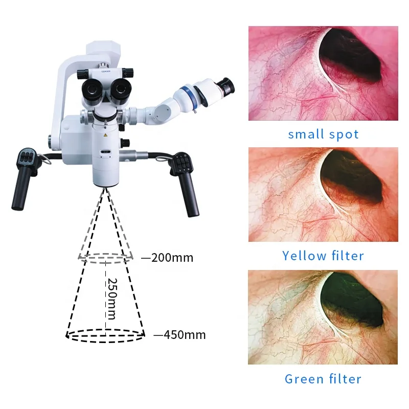 ASOM-5D neurosurgery ent microscope Multifunctional zumax binocular Autofocus microscope
