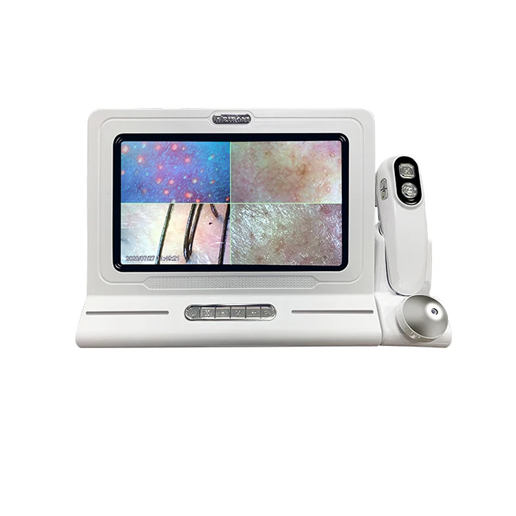 HD Display 50/200X Professional Hair Follicle Detector Scalp Diagnostic Machine Skin Analyzer Skin Tester