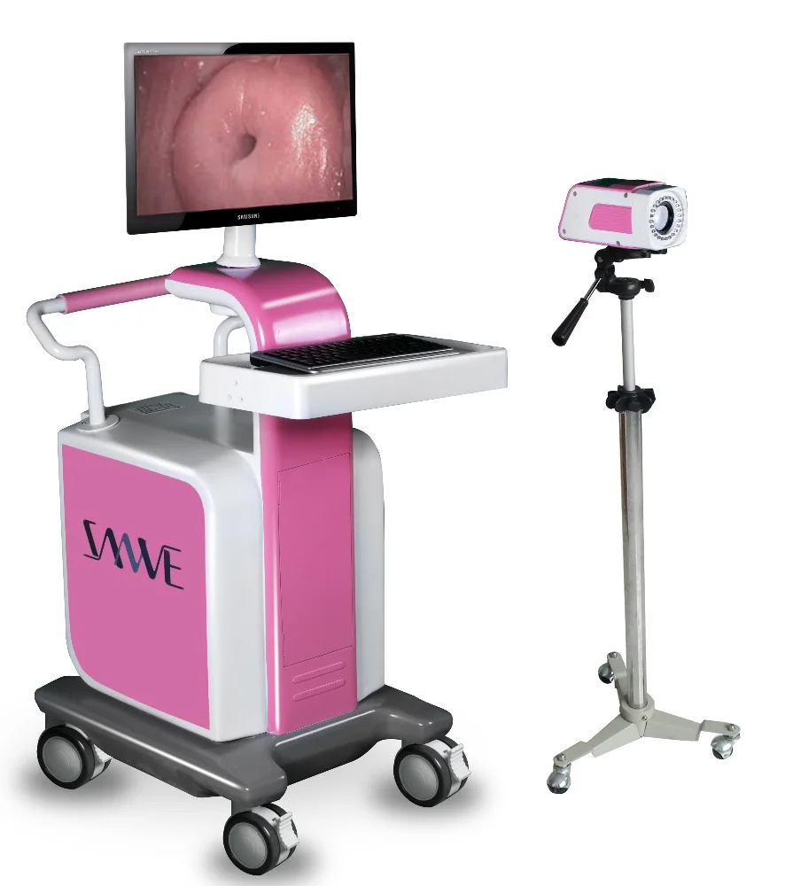 SANWE  SW-3303 Digital Colposcope   Electronic Colposcope  Colposcopy