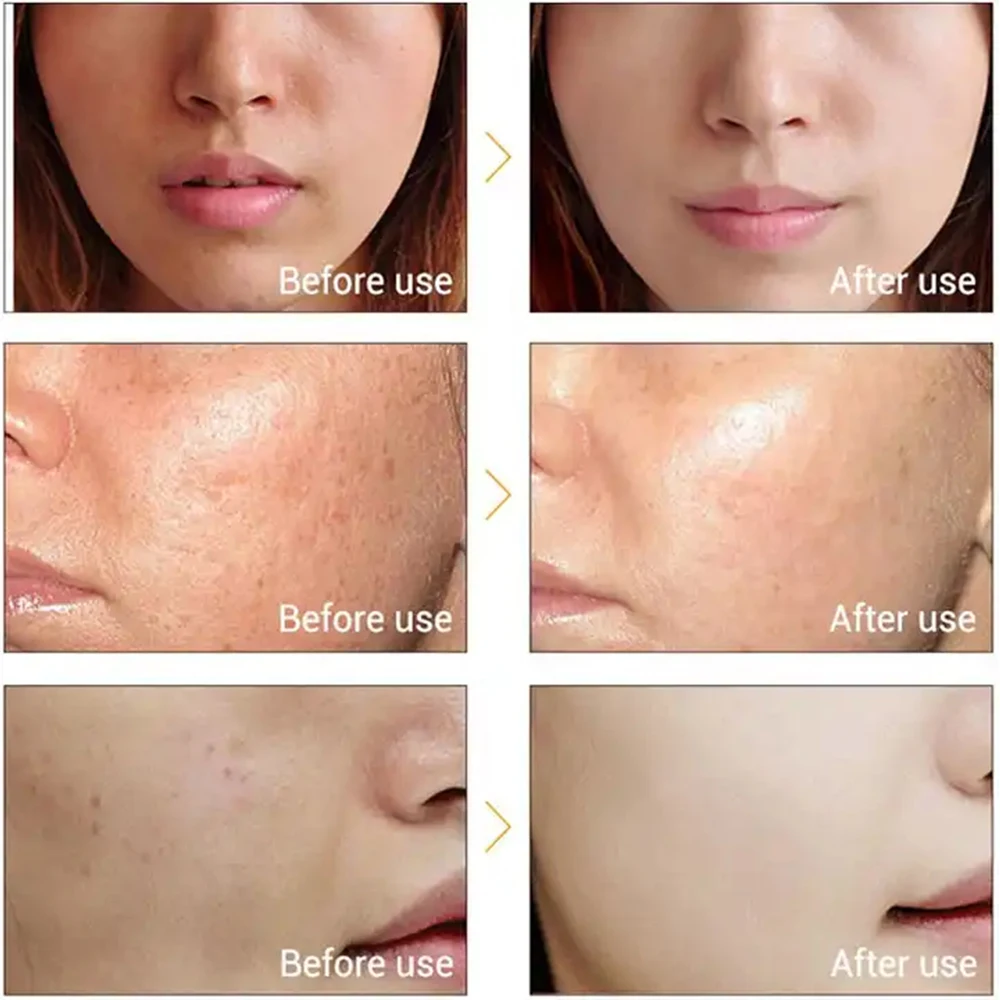 Korea glutathione Kojic Acid Skincare Serum Skin Whitening Facial Serum anti aging for Dark Spots Remover