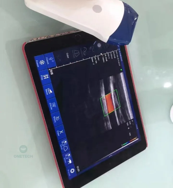C37A Portable 128 Element Wireless vascular USG Ultrasound Linear Ultrasound Probe