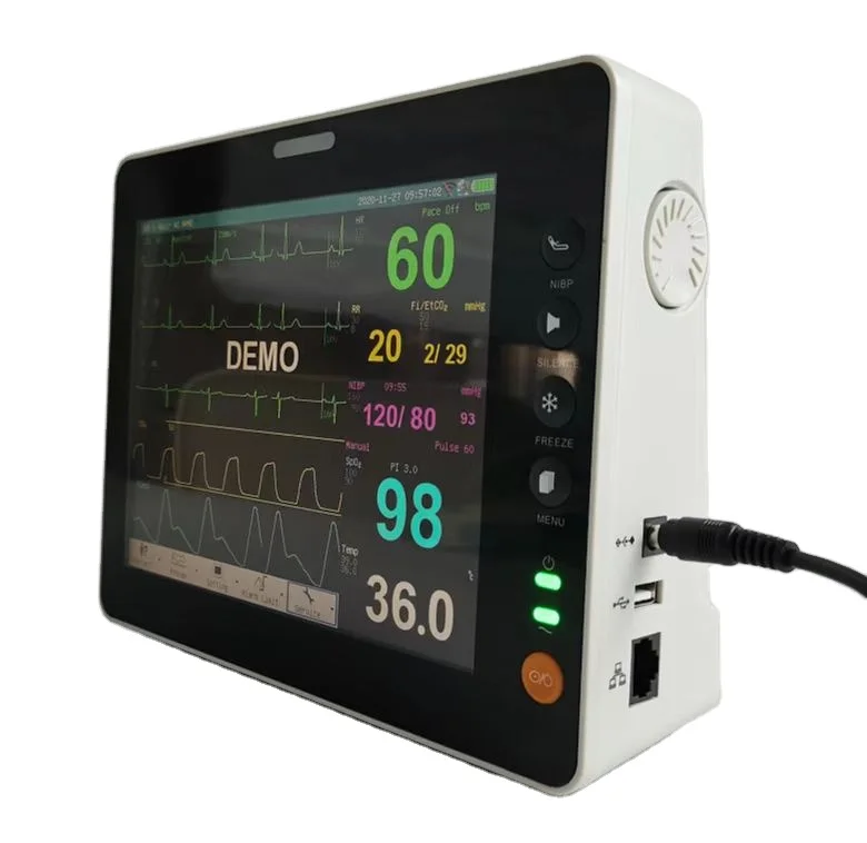 Veterinary Equipment, Vet Monitor 8 Inch for Animals Pets/Dogs with SpO2, ECG, NIBP, Temp, Resp, Pr Functions.
