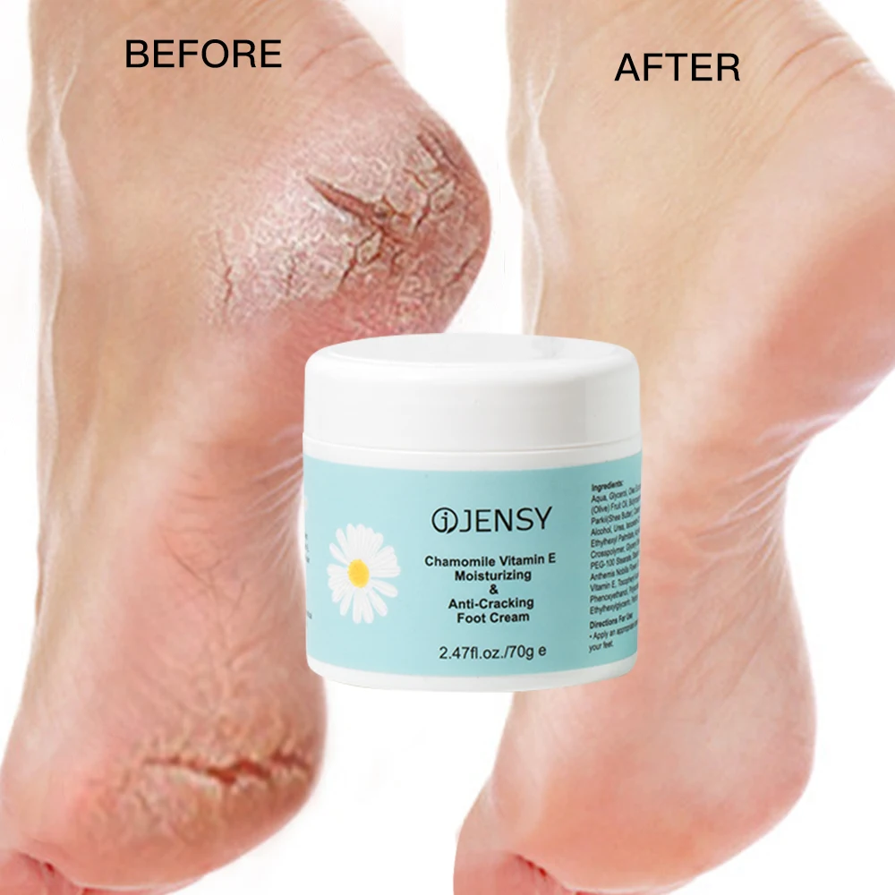 Custom peeling herbal dead skin removal vitamin c whitening vegan anti crack urea private label foot cream for cracked heels