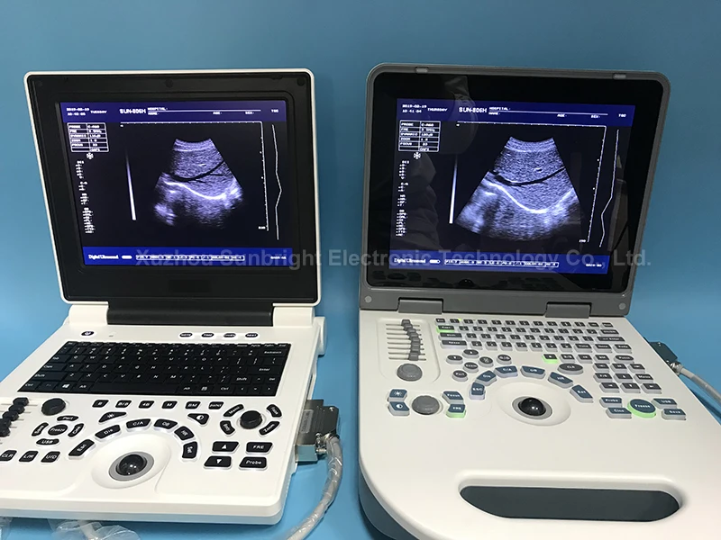Portable laptop type obstetric vascular medical ultrasonic system economical ultrasound machine