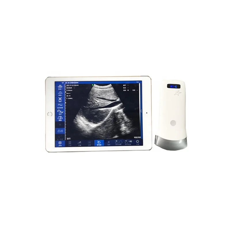 HD USB 5.5mm 720P HD Visual Endoscope Mini WIFI Control Eer Otoscope Camera