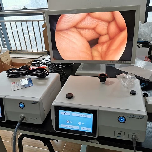Medical professinal vagina camera for gynecology