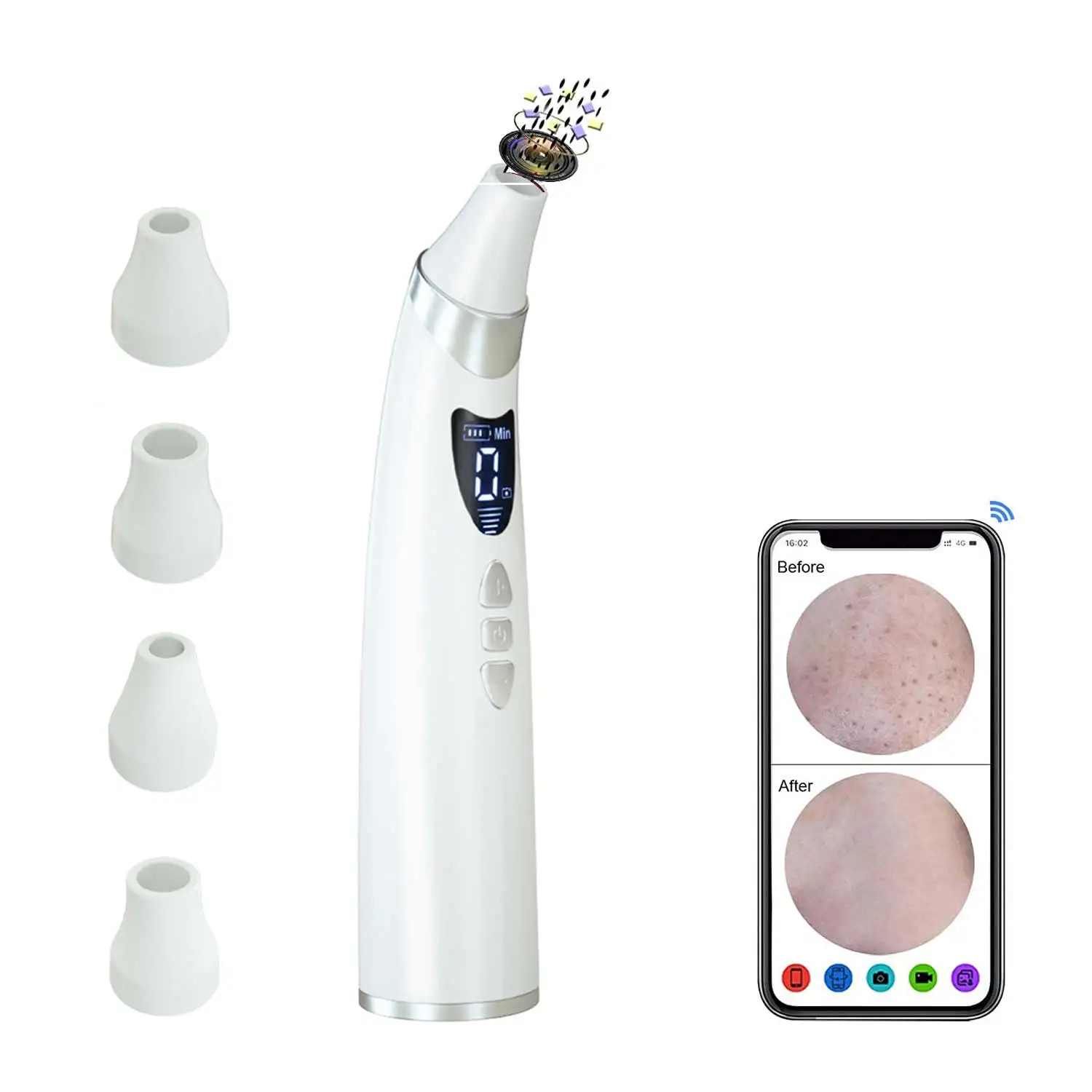 
2021 hot sale pore mini visual removing blackheads tool machine kit vacuum blackhead remover with camera 