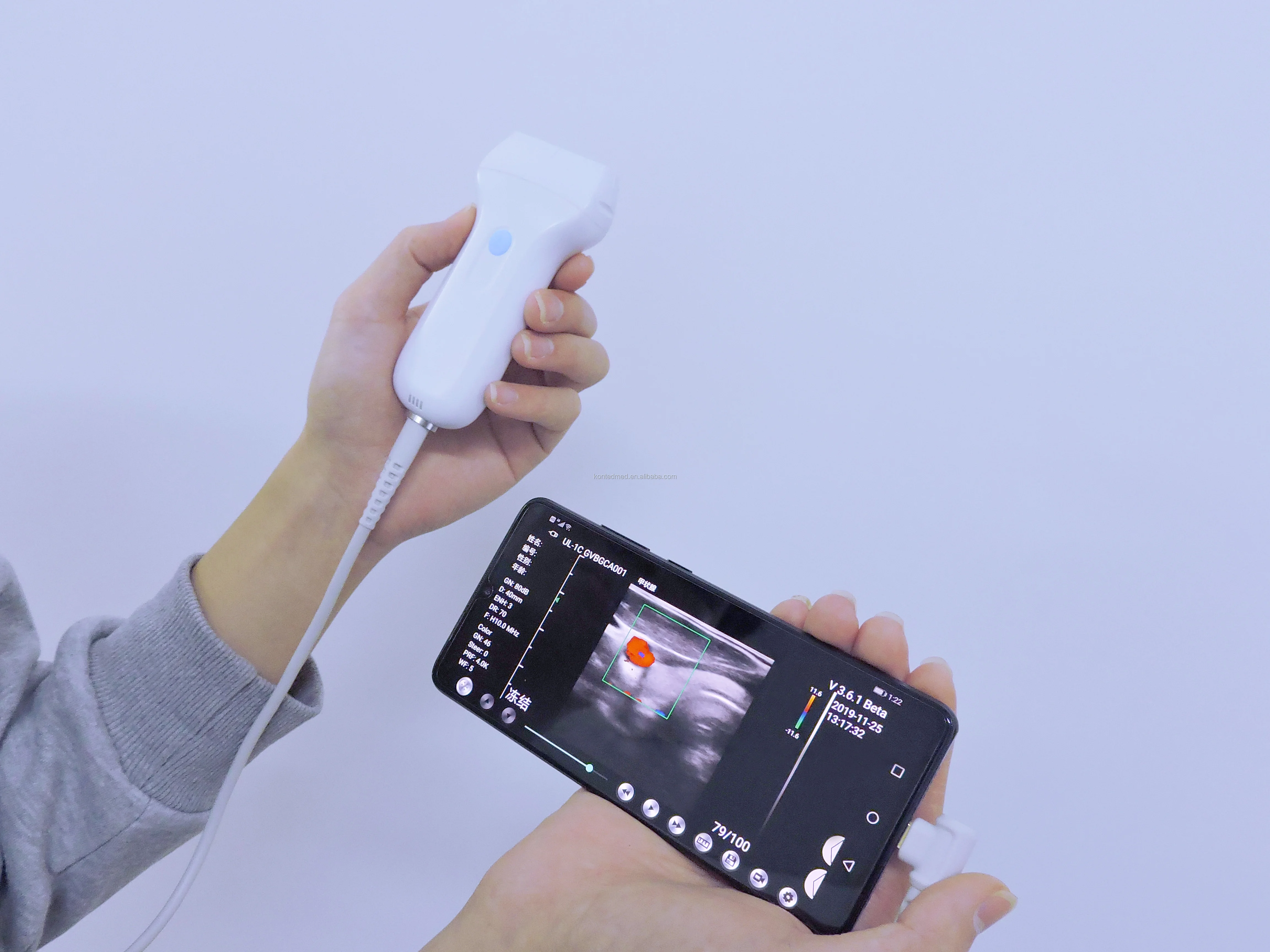 Usb Ultrasound Scanner Linear Transducer Machine Probe With Software For Windows