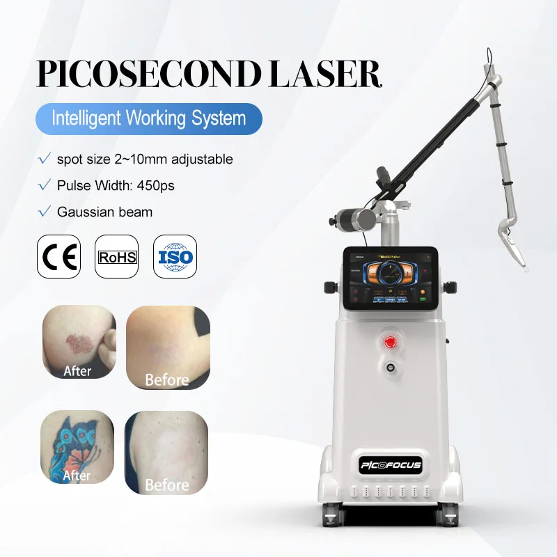 Nubway Cheap Price Picosecond Best Pico Laser Botched Ink Tattoo Removal Equipment Ce Approved Machine