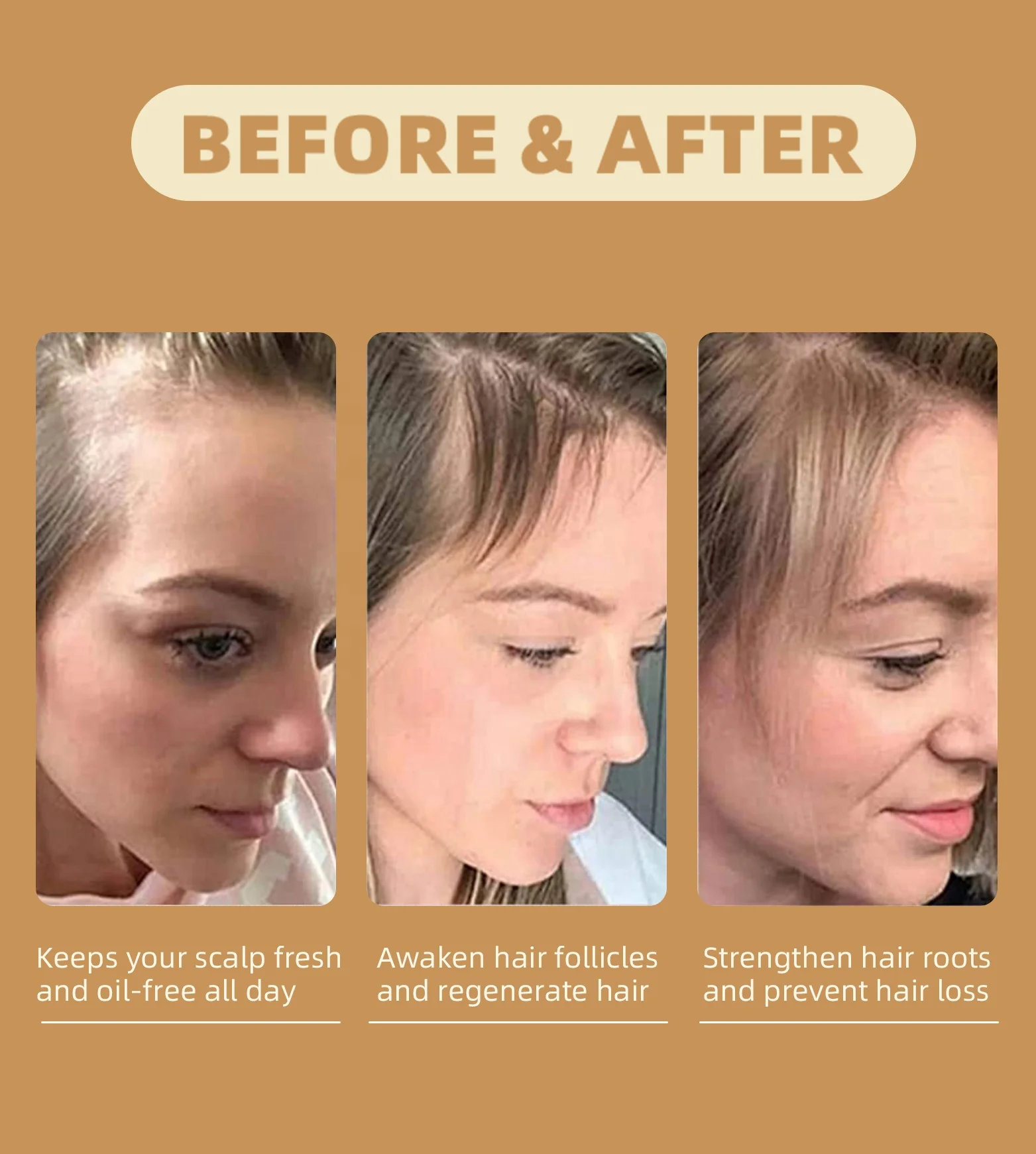 4 In 1 Ginger Ginseng Rosemary Argan Oil Scalp Care Hair Loss Regrowth Growth Oil Serum Bald Treatment For Men Women Ladies
