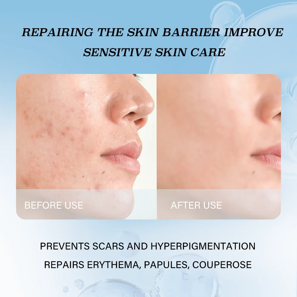 Individual Packaging Vegan Hydrate Plump Recombinant Type III Collagen Repair Facial Mask for Dry Acne Prone Sensitive Skin