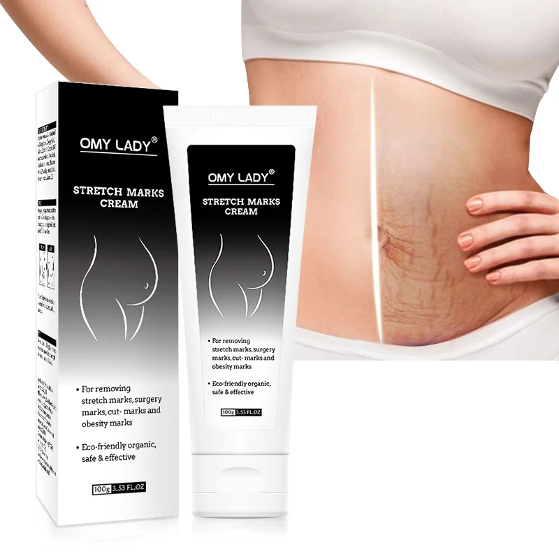 natural herbal formula stretch mark remover cream tcm Scar Removal Gel Women stretch marks remover