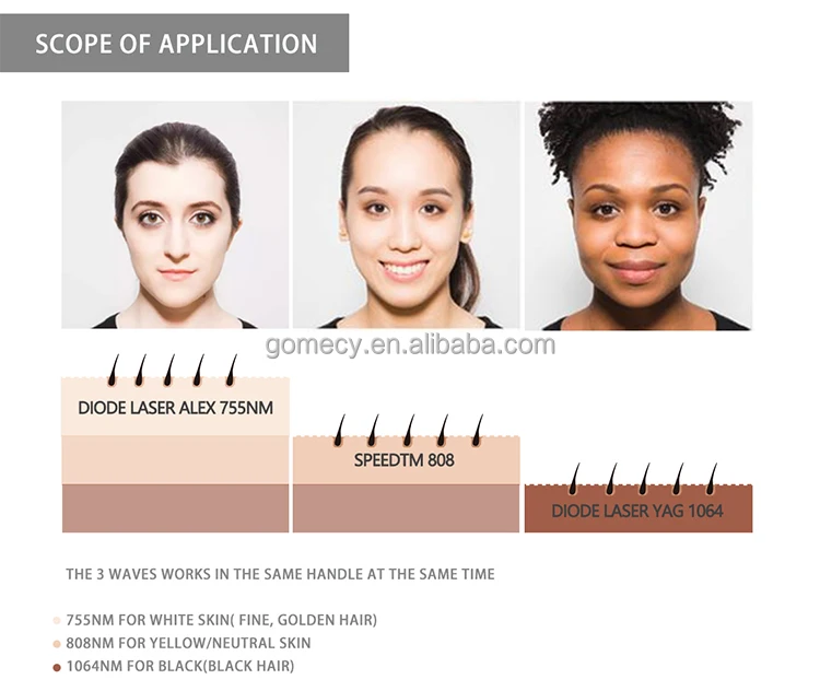 GOMECY-Multifunction-beauty-machine-3-in-1-elight-ipl-opt-rf-nd-yag-ipl-laser-hair-in-Beijing