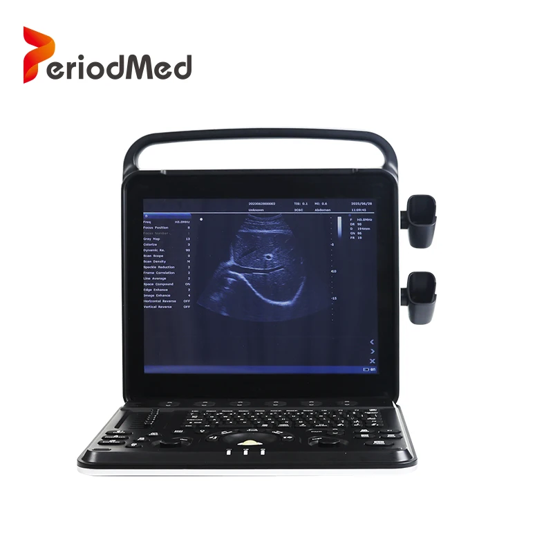 Periodmed Affordable Portable Medical Imaging Sale color doppler ultrasound machine