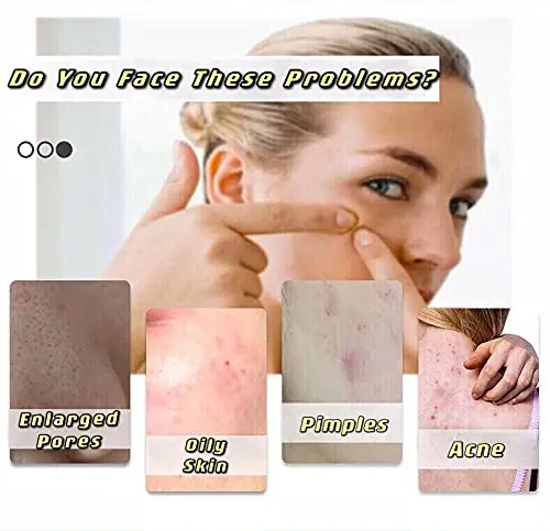 Natural Toilet Fresh Scent Soft Based Antiseptic Neem Aloe Vera Soaps