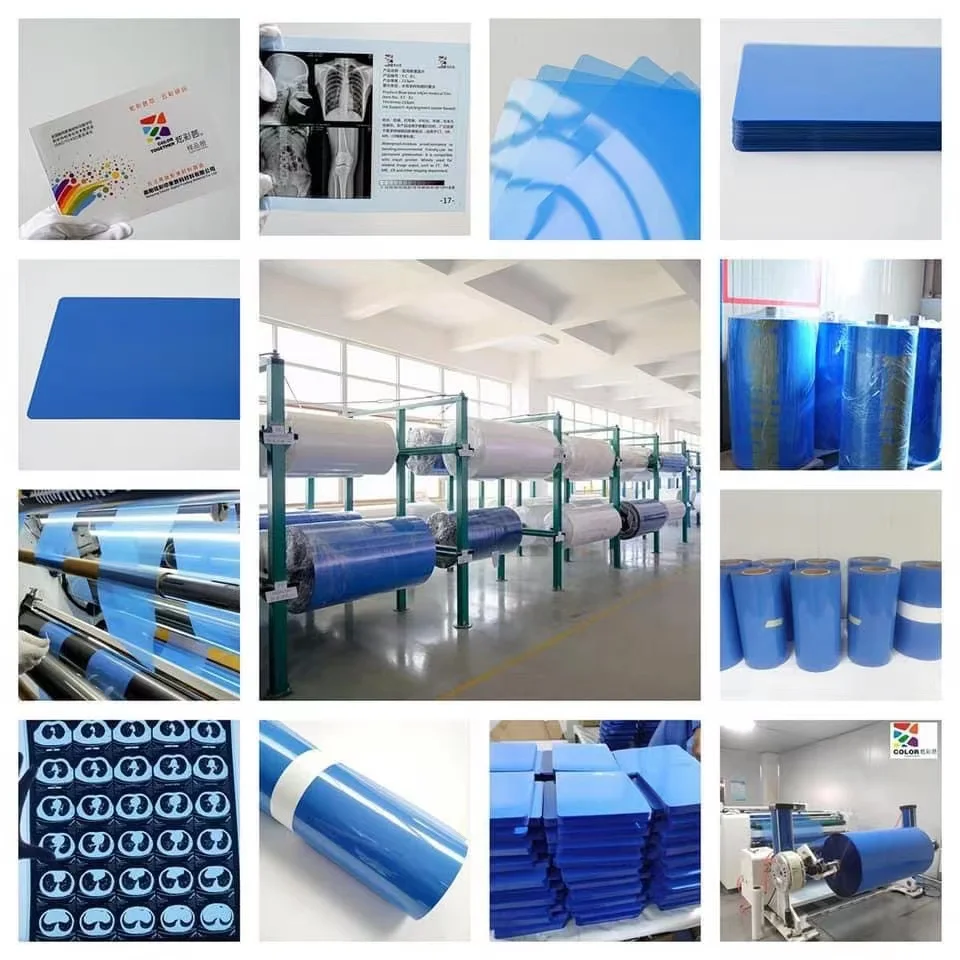 Medical Film Blue Thermal Film 210micron CT DR Film 8x10 10x12 11x14 14x17 Sheet for Medical Printing Media