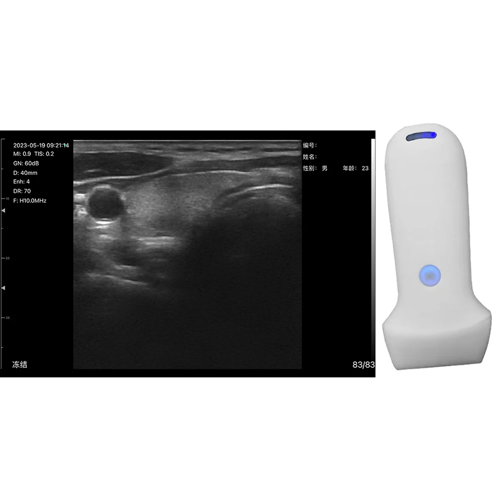 Handheld Portable Ultrasound Equipment for Veterinary Use Equine and Pig Ultrasound for Pregnancy Diagnosis