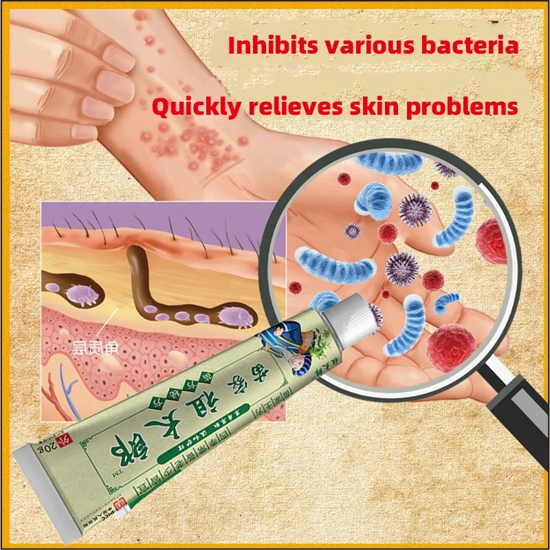 Anti-inflammatory Itching Relieve Skin Herbal  Disease Relieve Itching Pruritus Psoriasis Cream Ointment