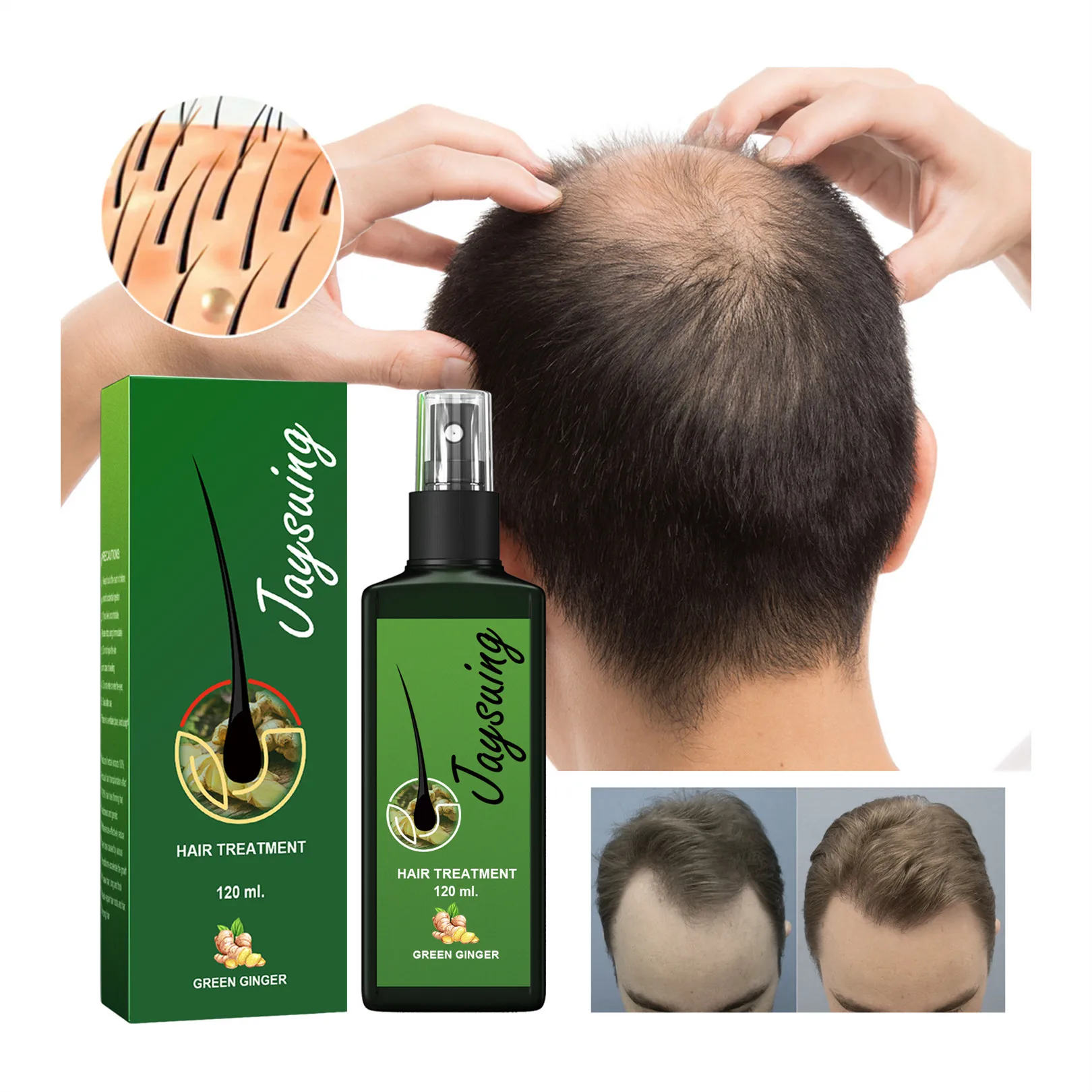 Ginger Liquid Spray for Women Men Regrowth Anti Hair Loss Oils for Hair Growth Hair growth intensive spray