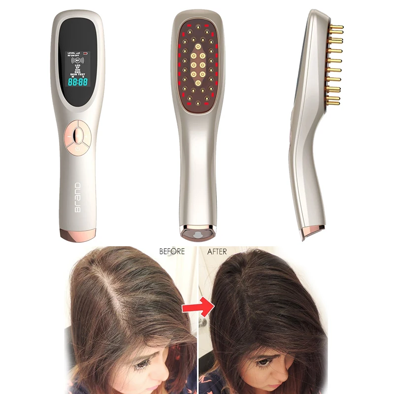 
10 Years Factory Free Sample High Quality Hair Loss Treatment For Men 