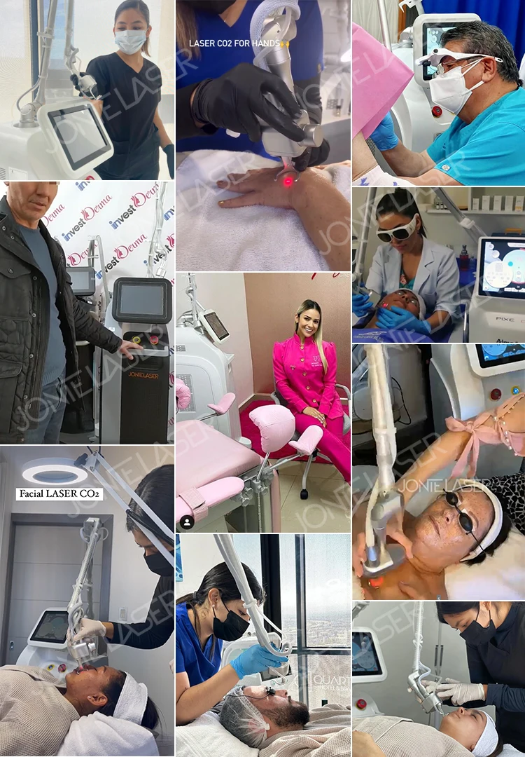 Stationary CO2 Fractional Laser Machine for Vaginal Skin Tightening and Scar Removal Laser Beauty Equipment