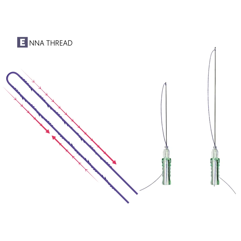 ENNA pdo suture 29g screw 38mm mono thread cog 4d thread for fio levantando pdo
