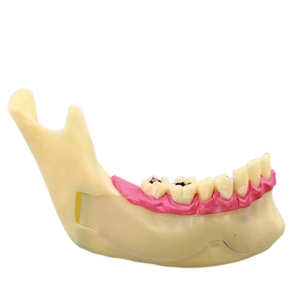 Gelsonlab HSDT-N14 Dental Decomposition Model Organization od Mandible Model
