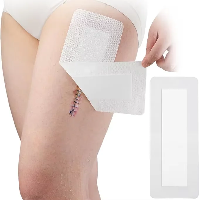 10cm*15cm Breathable Adhesive Non Woven Wound Dressing Sterilized Non Woven Dressings For Wound Care