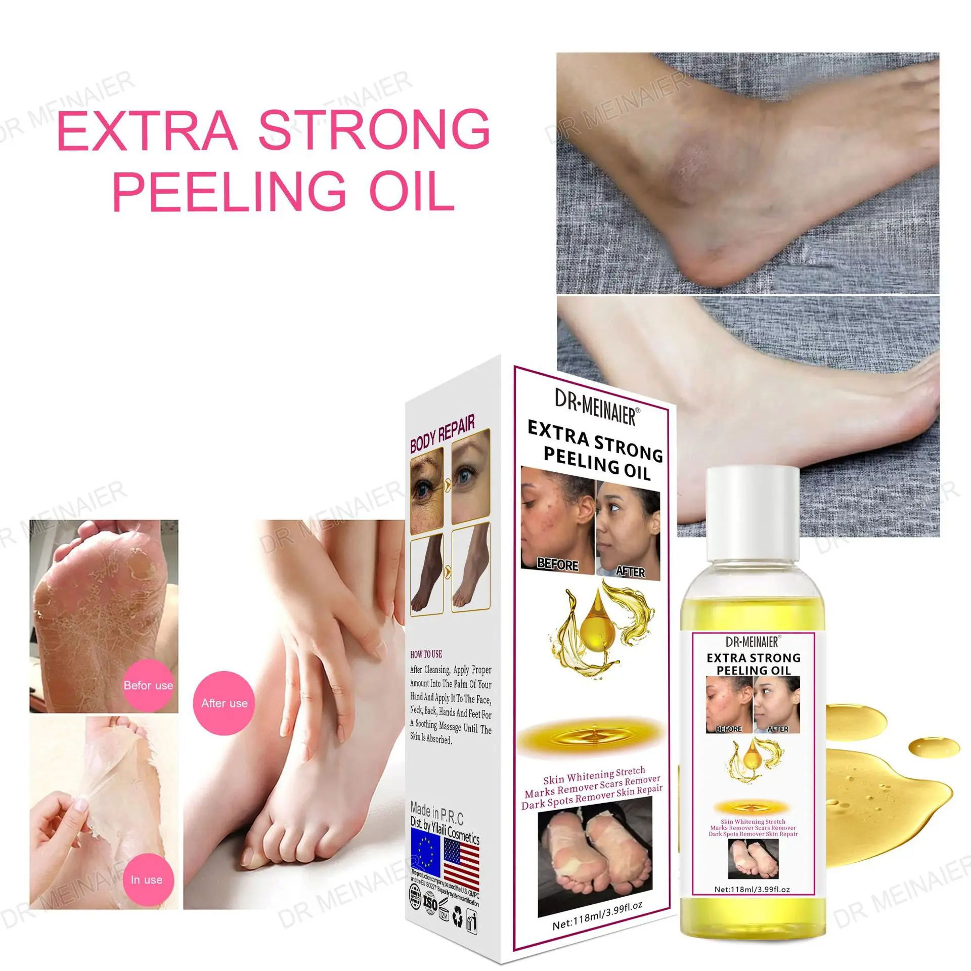 wholesale herbal black skin strong bleaching oil vitamin c dead skin remover african skin whitening yellow orange peeling oil