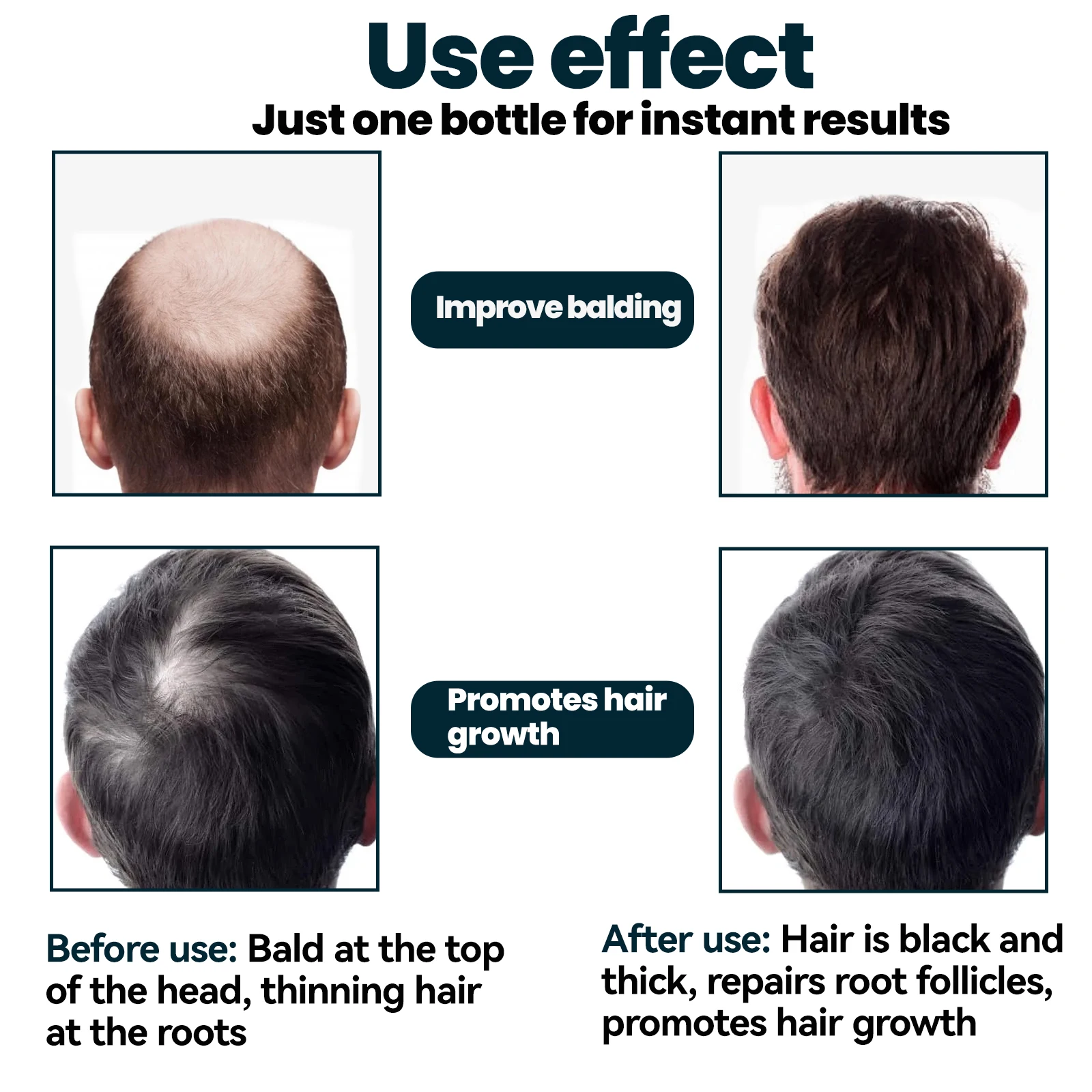 2024 Breakout product 60ml *3 bottles of Anti-hair loss Rapid HairGrowth Oil Hair Regeneration Treatment Serum for women and men